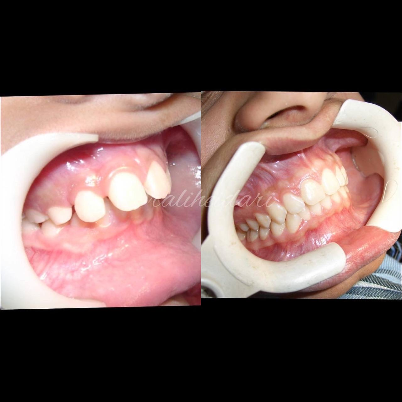 متخصص ارتودنسی کودک متخصص ارتودنسی کودک