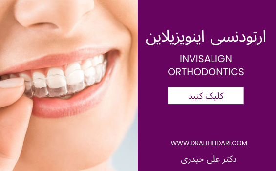 ارتودنسی اینویزیلاین