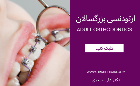 ارتودنسی بزرگسالان ارتودنسی بزرگسالان