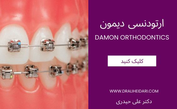 ارتودنسی دیمون